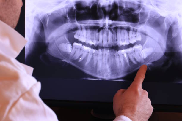 Best Emergency Dentist for Knocked-Out Tooth in Minerva, OH