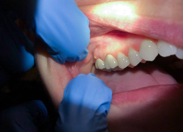 Best Broken or Cracked Tooth Emergency Dentist in Minerva, OH