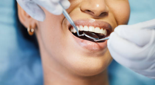 Best Emergency Dentist for Lost Fillings or Crowns in Minerva, OH